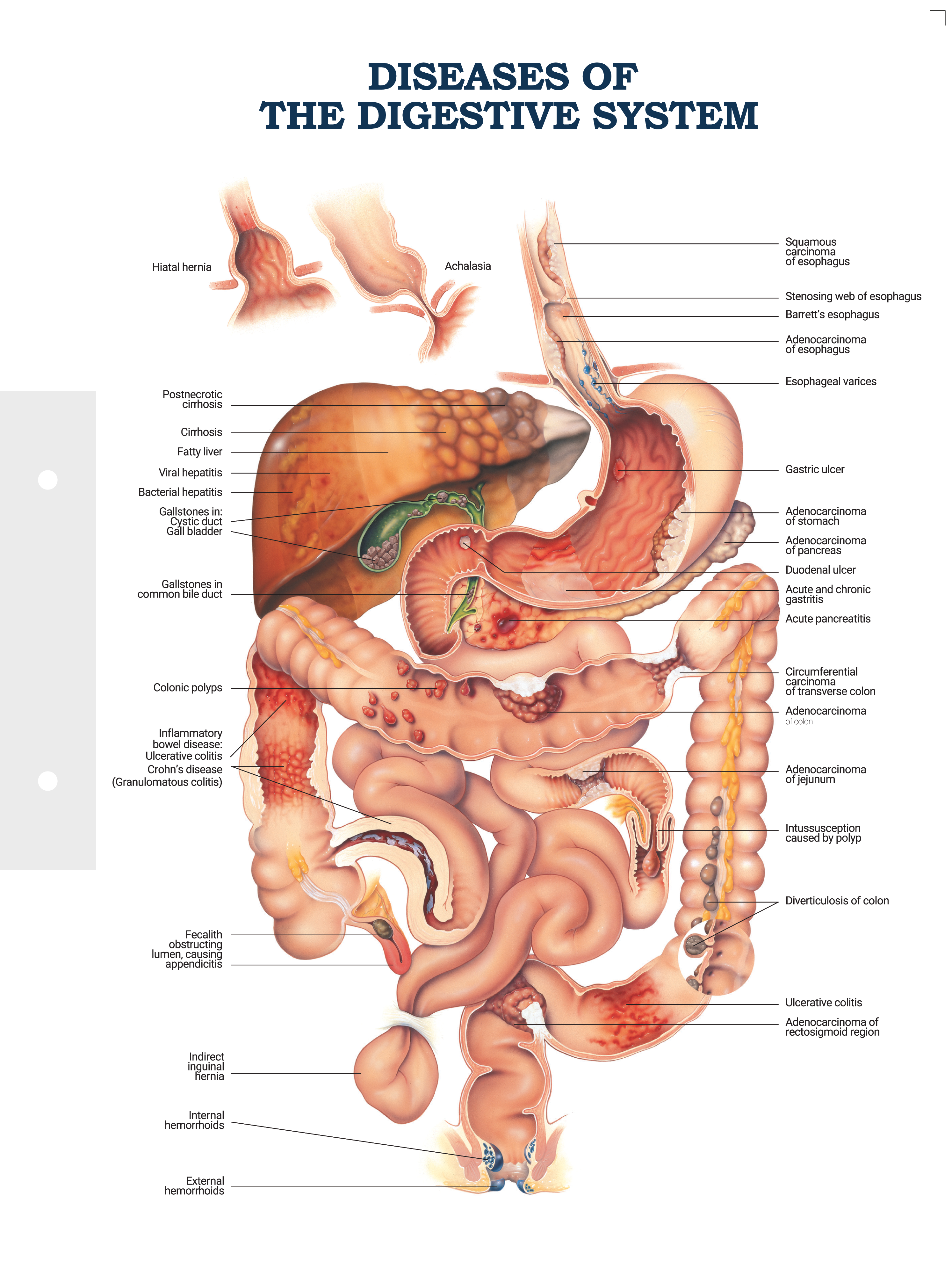 Diseases of the digestive system